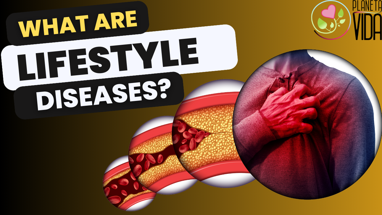 Q100 - What Are Lifestyle Diseases - EN